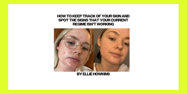 How to keep track of your skin and spot the signs that your current regime isn’t working