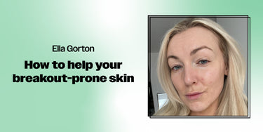 How to help your breakout-prone skin with Ella Gorton