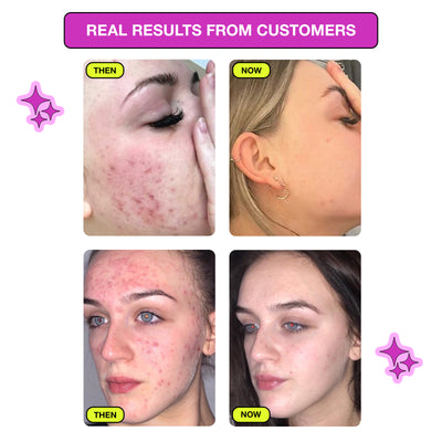 VaPOREize Niacinamide Facial Tonic