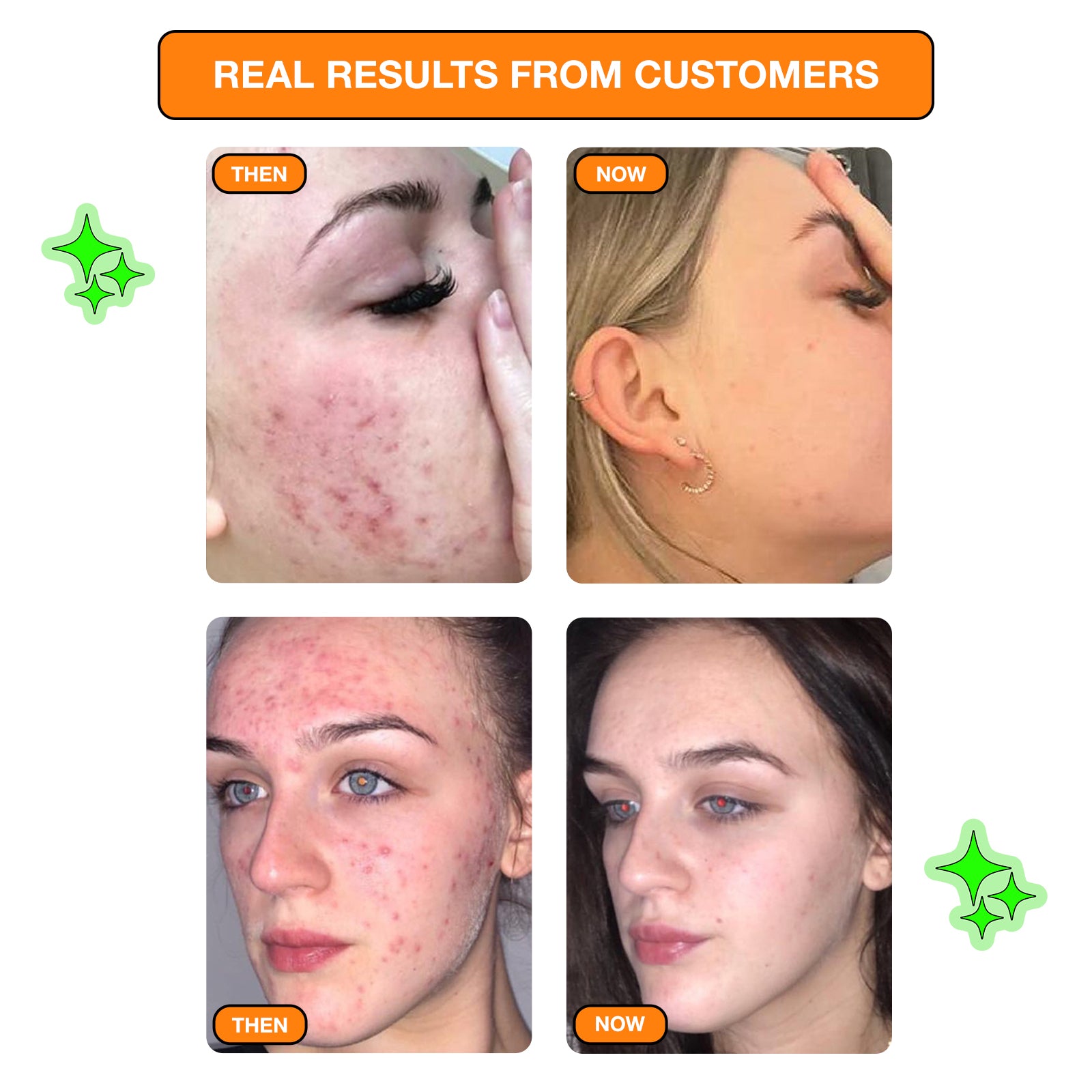 Pow Patch - Vitamin C Spot Patches