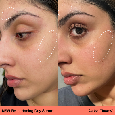 Re-surfacing Day Serum